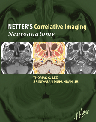 Netter’s Correlative Imaging: Neuroanatomy