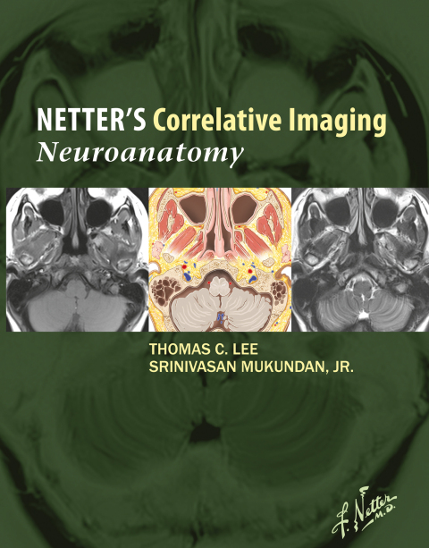 Cover image for book Netter’s Correlative Imaging: Neuroanatomy