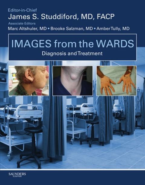 Images from the Wards: Diagnosis and Treatment 