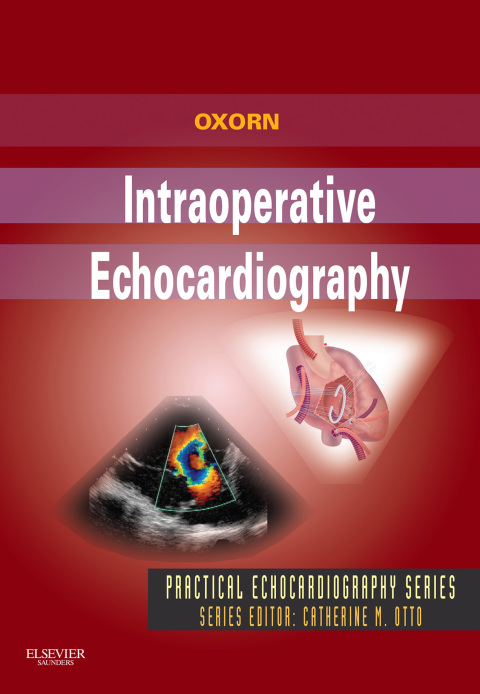 Cover image for book Intraoperative Echocardiography