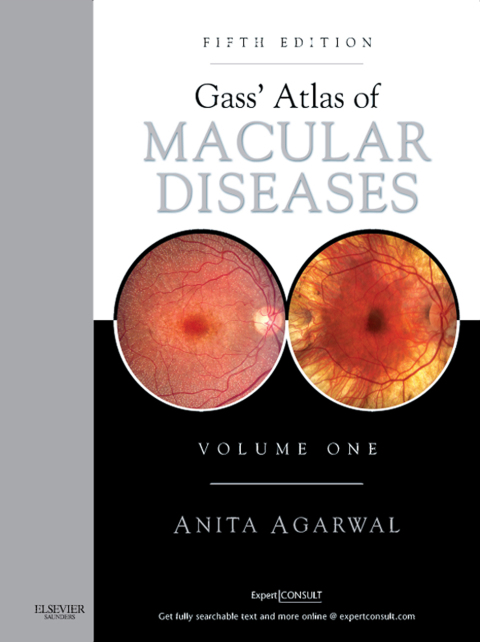 Cover image for book Gass' Atlas of Macular Diseases