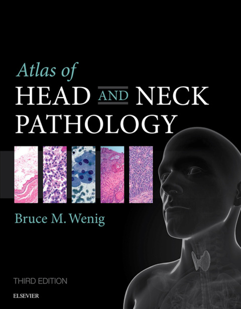Cover image for book Atlas of Head and Neck Pathology E-Book