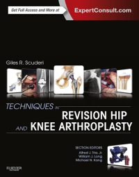صورة الغلاف: Techniques in Revision Hip and Knee Arthroplasty 9781455723683