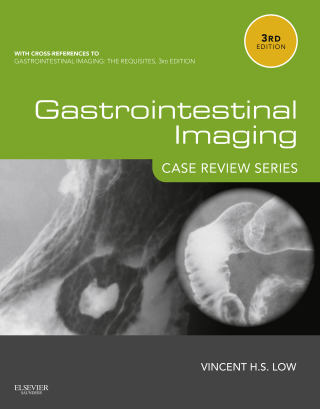 Gastrointestinal Imaging: Case Review Series