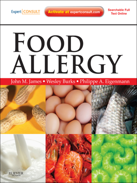 Cover image for book Food Allergy