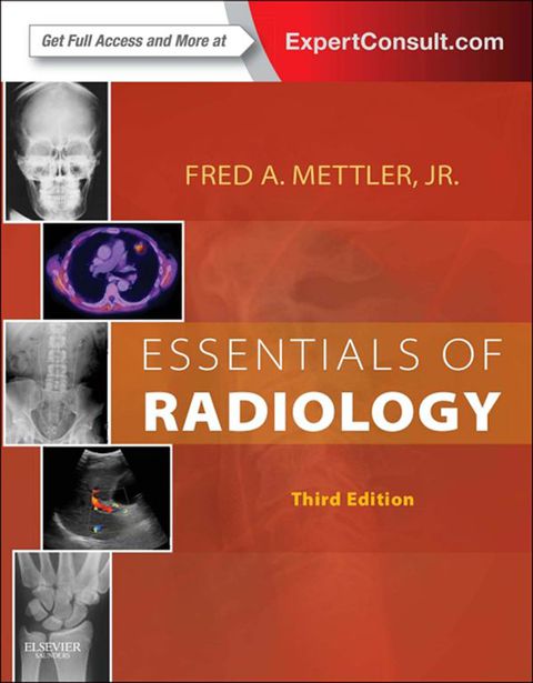 Cover image for book Essentials of Radiology