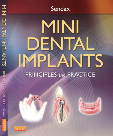 Cover image for book Mini Dental Implants