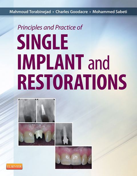 Cover image for book Principles and Practice of Single Implant and Restorations