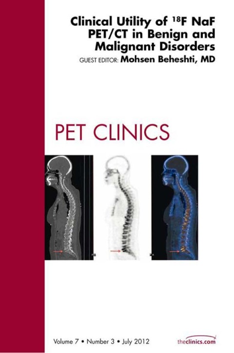 Cover image for book Clinical Utility of 18NaF PET/CT in Benign and Malignant Disorders, An Issue of PET Clinics