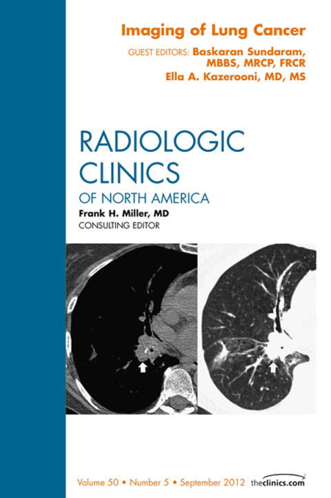 Cover image for book Imaging of Lung Cancer, An Issue of Radiologic Clinics of North America