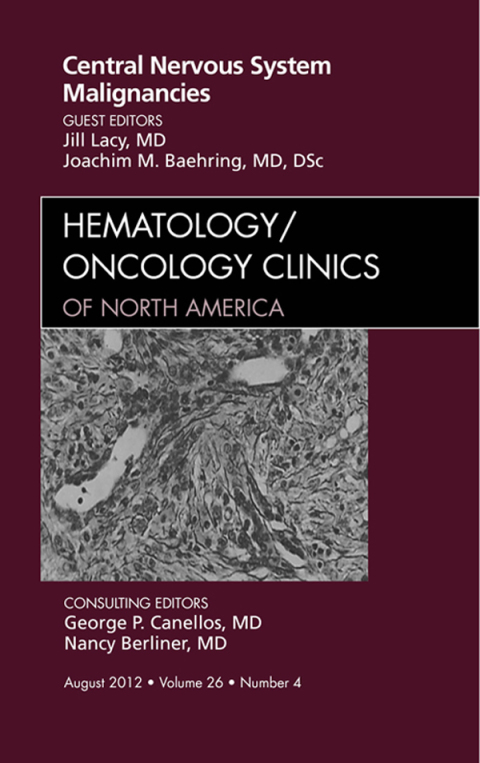 Cover image for book Central Nervous System Malignancies, An Issue of Hematology/Oncology Clinics of North America