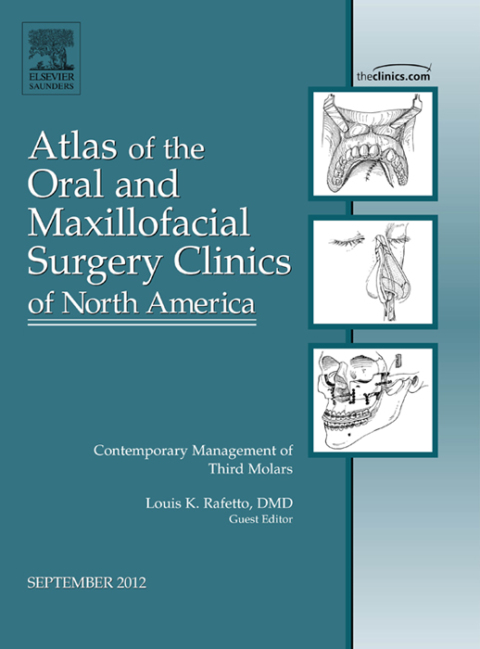 Cover image for book Contemporary Management of Third Molars, An Issue of Atlas of the Oral and Maxillofacial Surgery Clinics