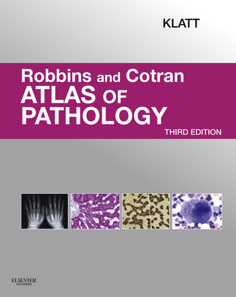 Cover image for book Robbins and Cotran Atlas of Pathology