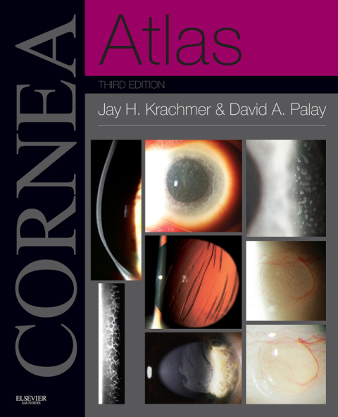 Cover image for book Cornea Atlas