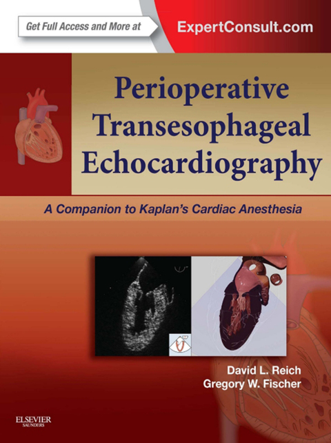 Cover image for book Perioperative Transesophageal Echocardiography