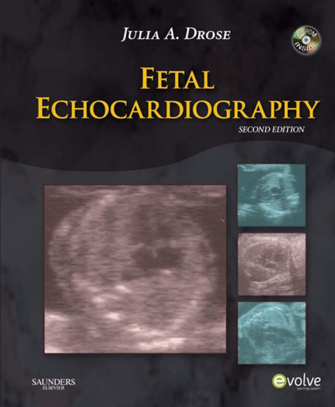 Cover image for book Fetal Echocardiography