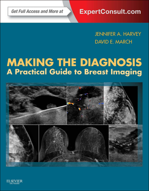Cover image for book Making the Diagnosis: A Practical Guide to Breast Imaging