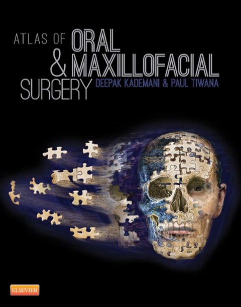 Cover image for book Atlas of Oral and Maxillofacial Surgery