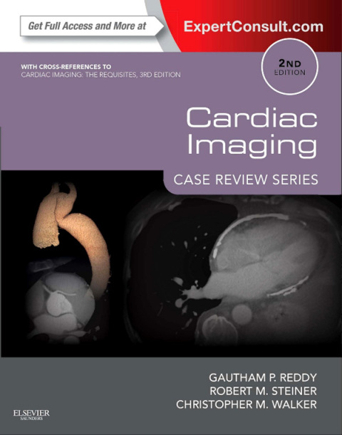 Cardiac Imaging: Case Review Series 