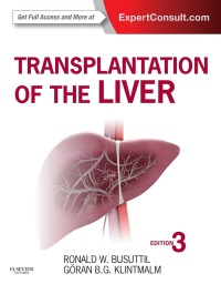 Cover image: Transplantation of the Liver 3rd edition 9781455702688