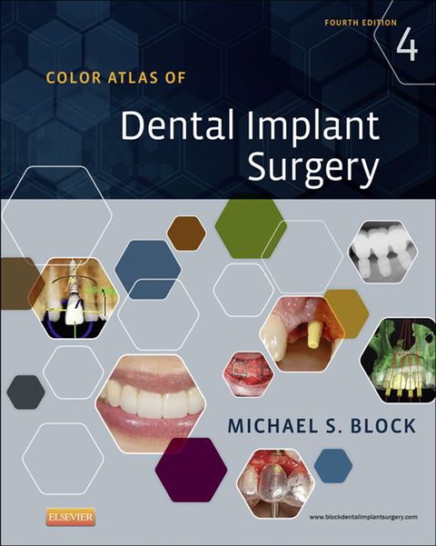 Cover image for book Color Atlas of Dental Implant Surgery