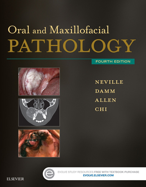 Cover image for book Oral and Maxillofacial Pathology
