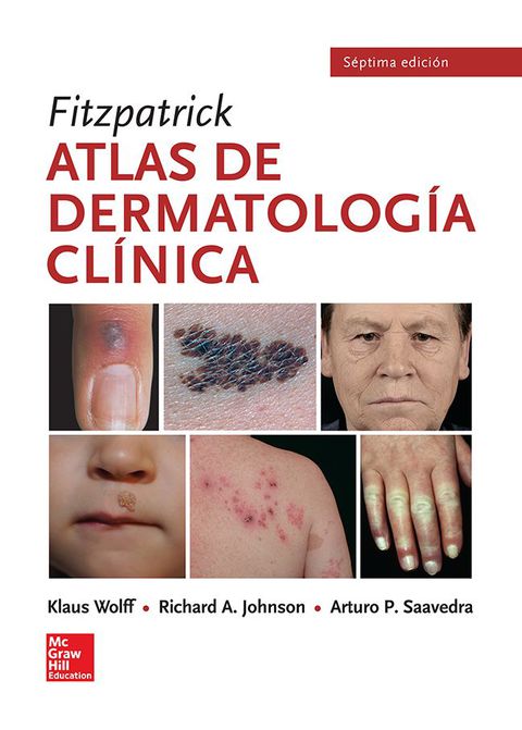 Cover image for book Fitzpatrick. Atlas de dermatología clínica