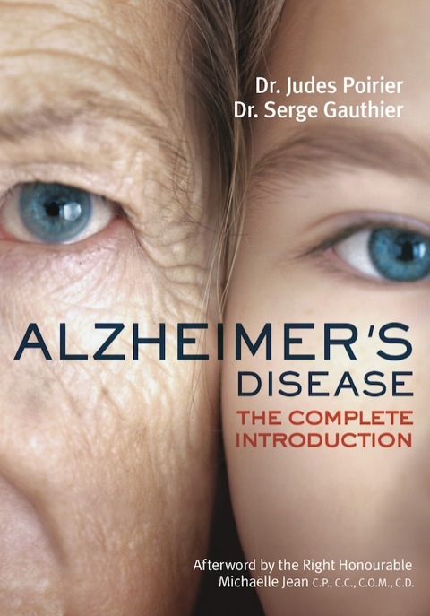 Cover image for book Alzheimer's Disease