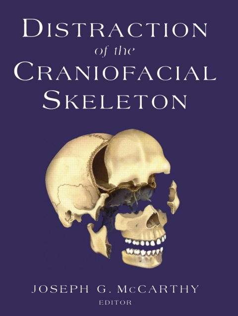 Distraction of the Craniofacial Skeleton 