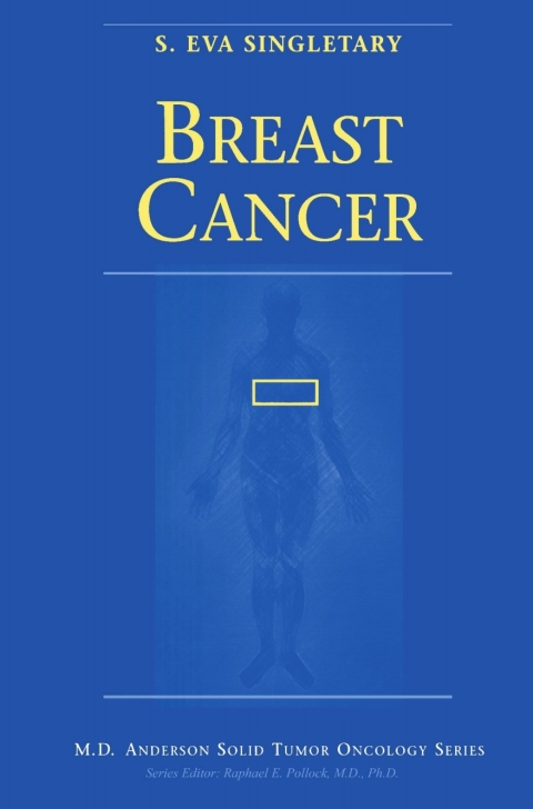 Cover image for book Breast Cancer