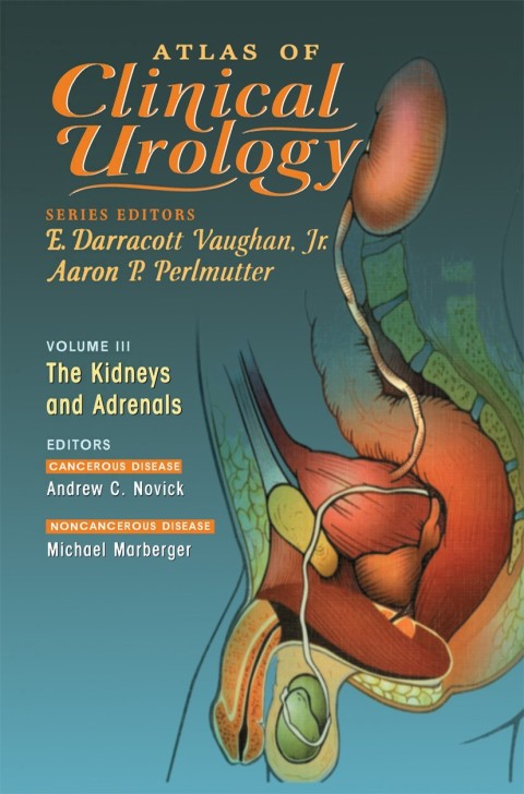 Atlas of Clinical Urology 
