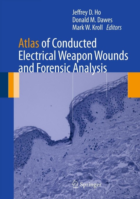 Cover image for book Atlas of Conducted Electrical Weapon Wounds and Forensic Analysis