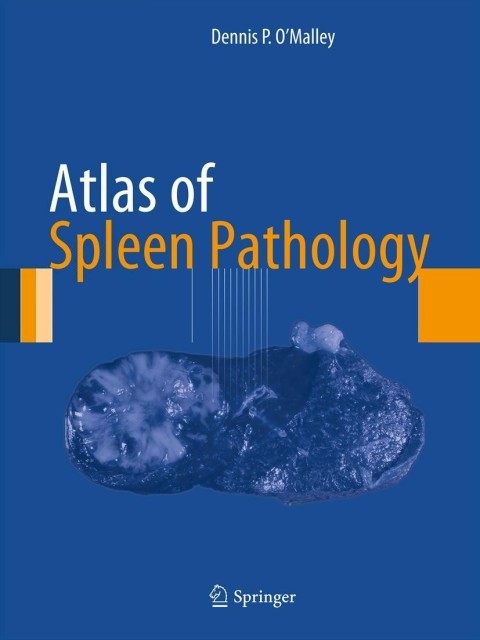 Cover image for book Atlas of Spleen Pathology