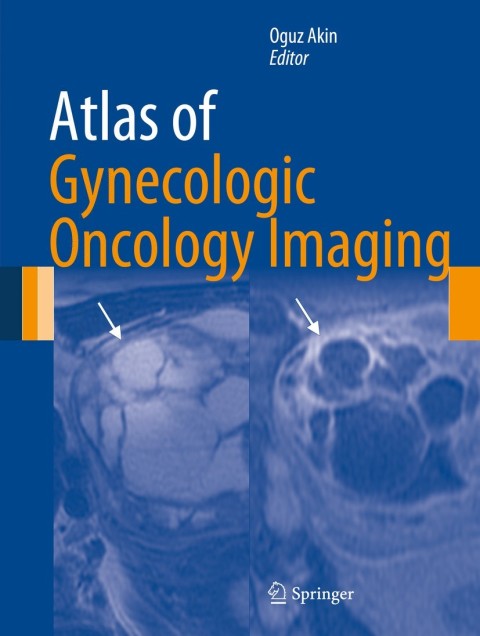 Cover image for book Atlas of Gynecologic Oncology Imaging