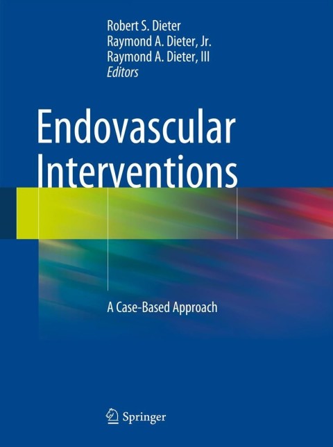 Cover image for book Endovascular Interventions