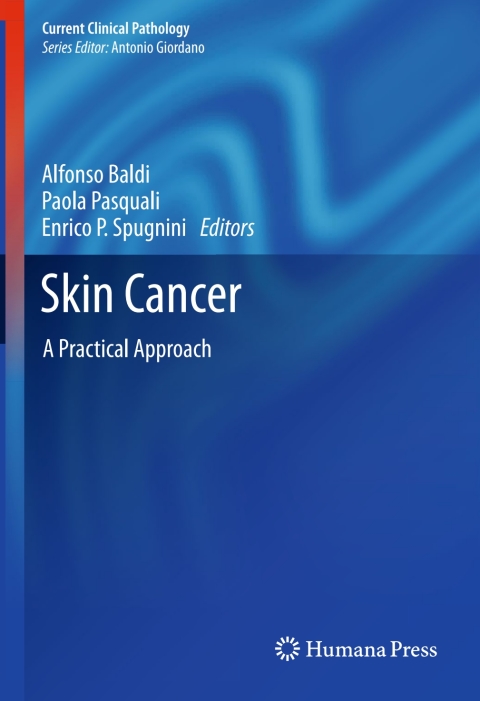 Cover image for book Skin Cancer