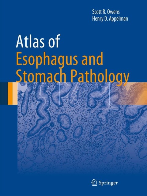 Cover image for book Atlas of Esophagus and Stomach Pathology