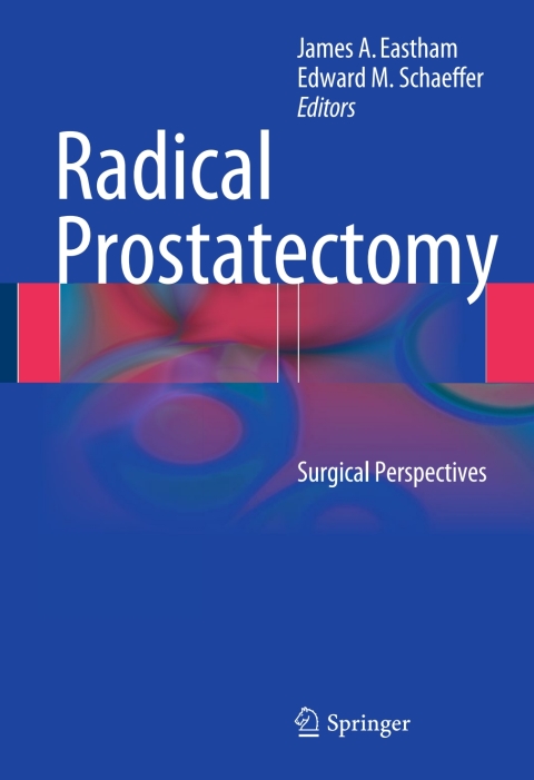 Cover image for book Radical Prostatectomy