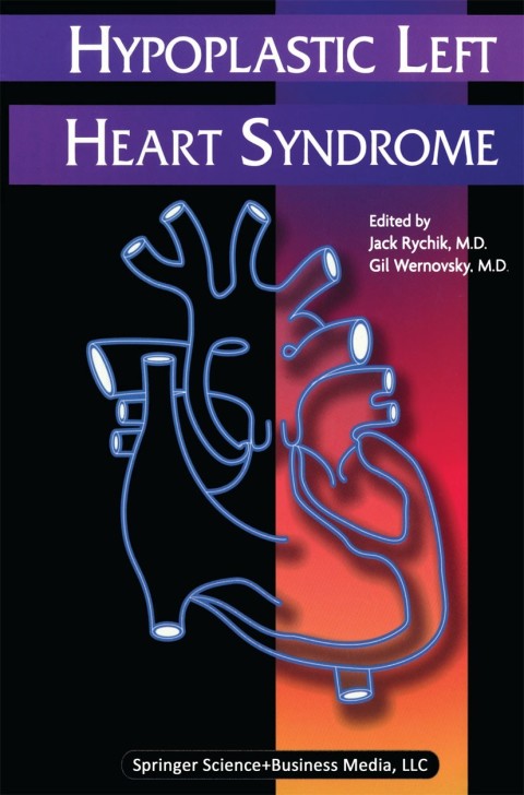 Cover image for book Hypoplastic Left Heart Syndrome