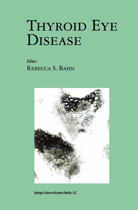 Cover image for book Thyroid Eye Disease