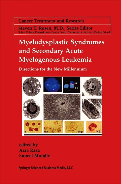 Cover image for book Myelodysplastic Syndromes & Secondary Acute Myelogenous Leukemia