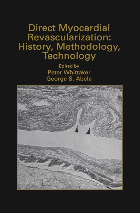 Cover image for book Direct Myocardial Revascularization: History, Methodology, Technology