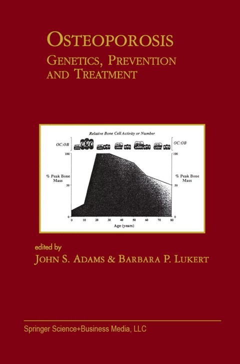 Cover image for book Osteoporosis
