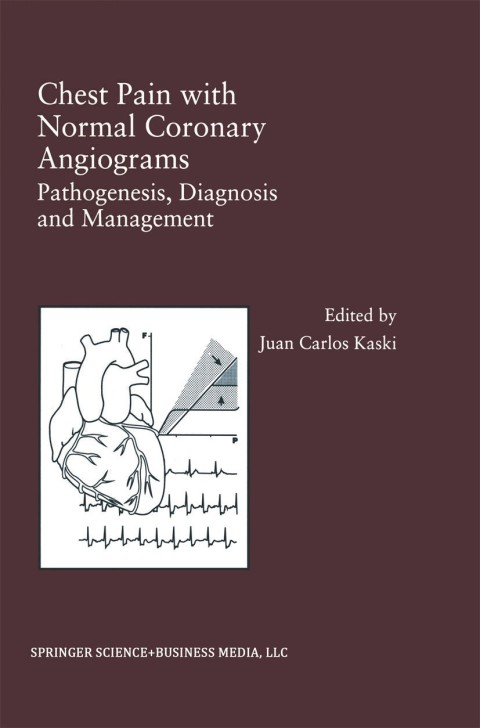 Cover image for book Chest Pain with Normal Coronary Angiograms: Pathogenesis, Diagnosis and Management