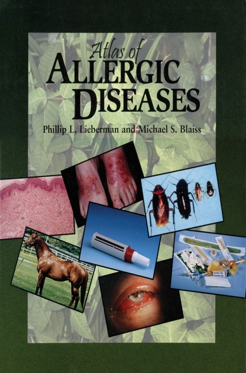 Cover image for book Atlas of Allergic Diseases