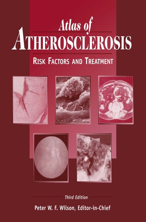 Atlas of Atherosclerosis 