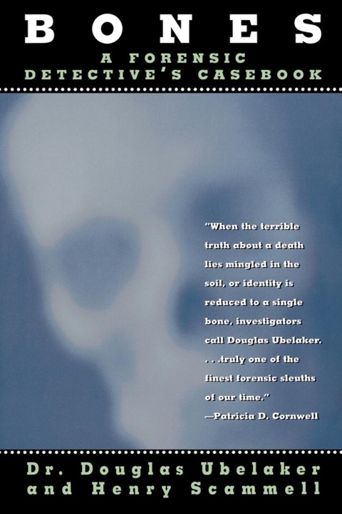 Bones 