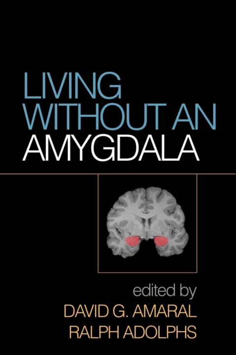 Cover image for book Living without an Amygdala