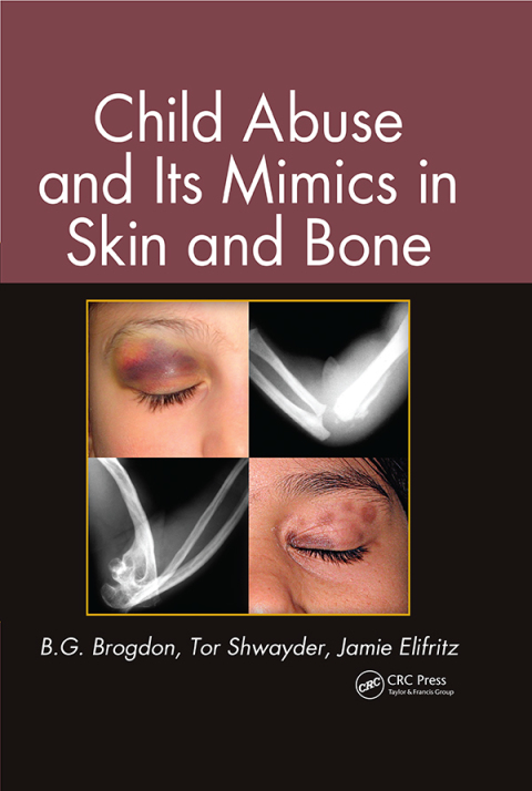 Cover image for book Child Abuse and its Mimics in Skin and Bone