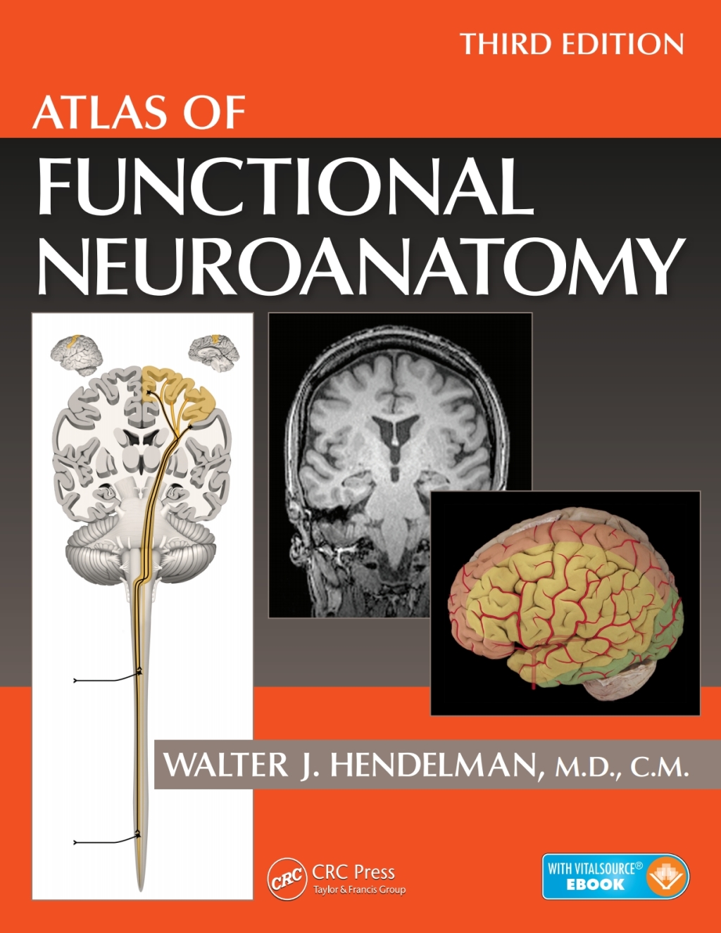 Atlas of Functional Neuroanatomy (eBook Rental) Atlas of Functional Neuroanatomy (eBook Rental)